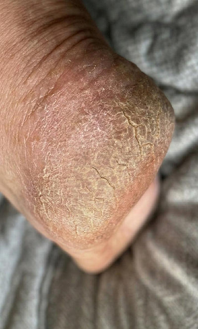 Before - Sarah M.